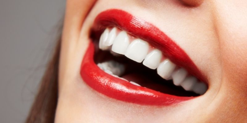 teeth whitening affiliate programs